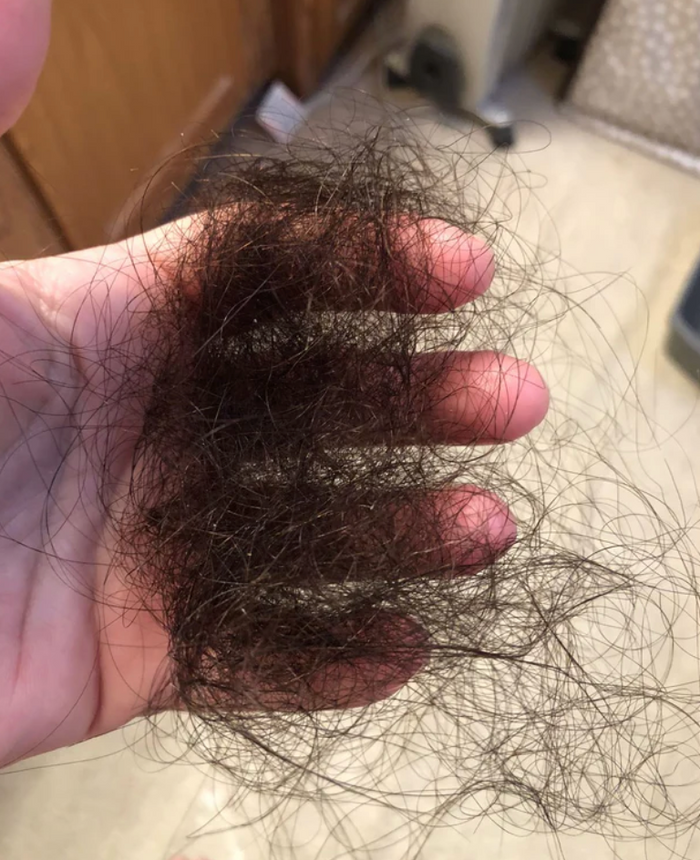 Vos cheveux continuent de s’affiner, même après avoir essayé tous les produits possibles.